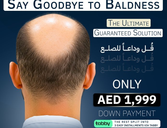 الحل الشامل لاستعادة الشعر والكثافة: فيلا الجراحة من Cocoona في جميرا دبي